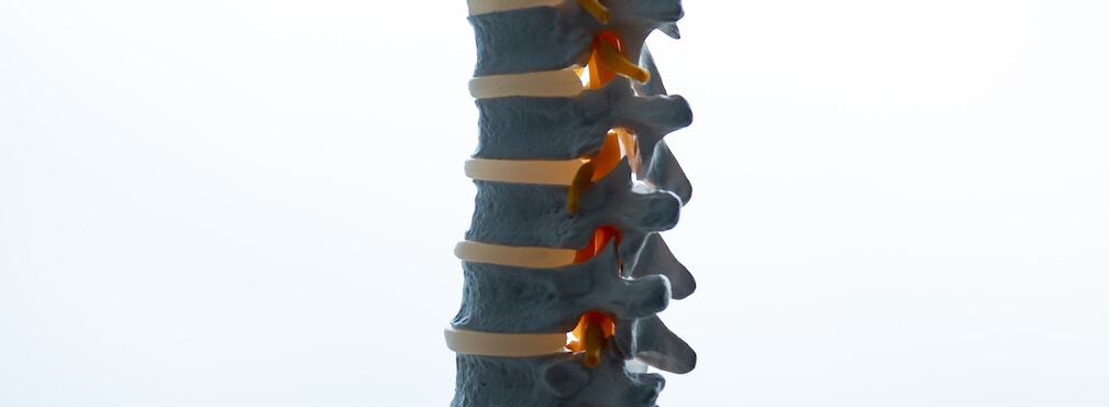 Kennesaw AICA spine vertebrae